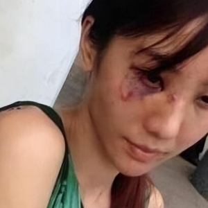 沉默的代价：隐瞒婚史遭暴打的痛苦自述